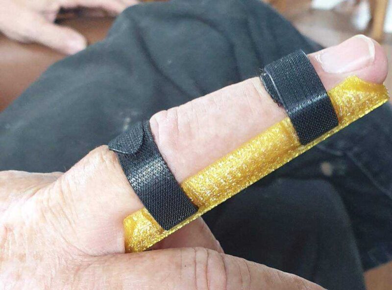Vingerspalk (Finger Splint Brace) Plastik Aparat - Görsel 2