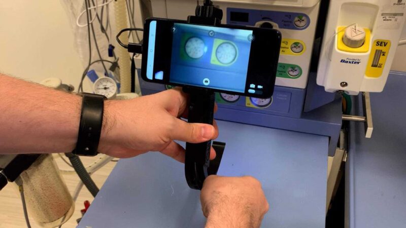 Entegre Telefon Dağılı Video Laryngoscope Plastik Aparat - Görsel 2