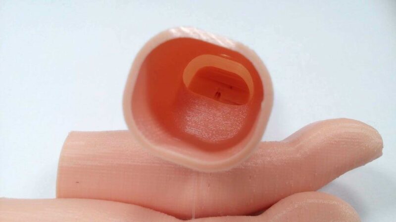 Flexy-Parmak Protezi Plastik Aparat - Görsel 4
